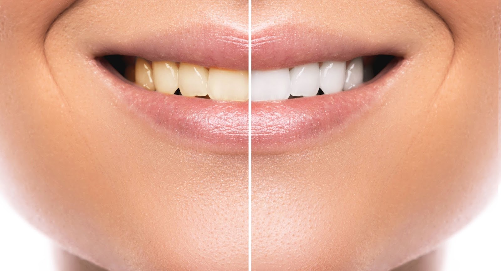 How to Maintain Whiter Teeth After Whitening: Tips and Tricks