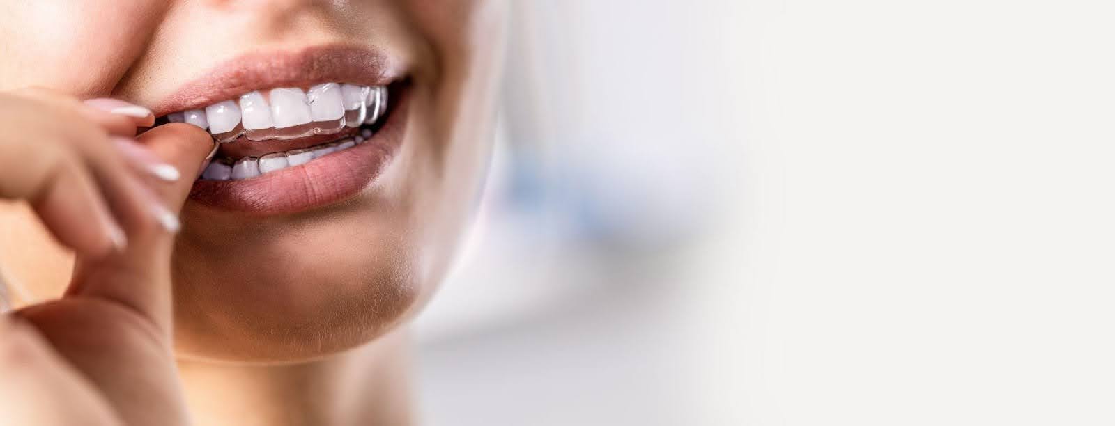 A woman uses a toothbrush to brush her teeth, emphasizing the importance of daily dental care