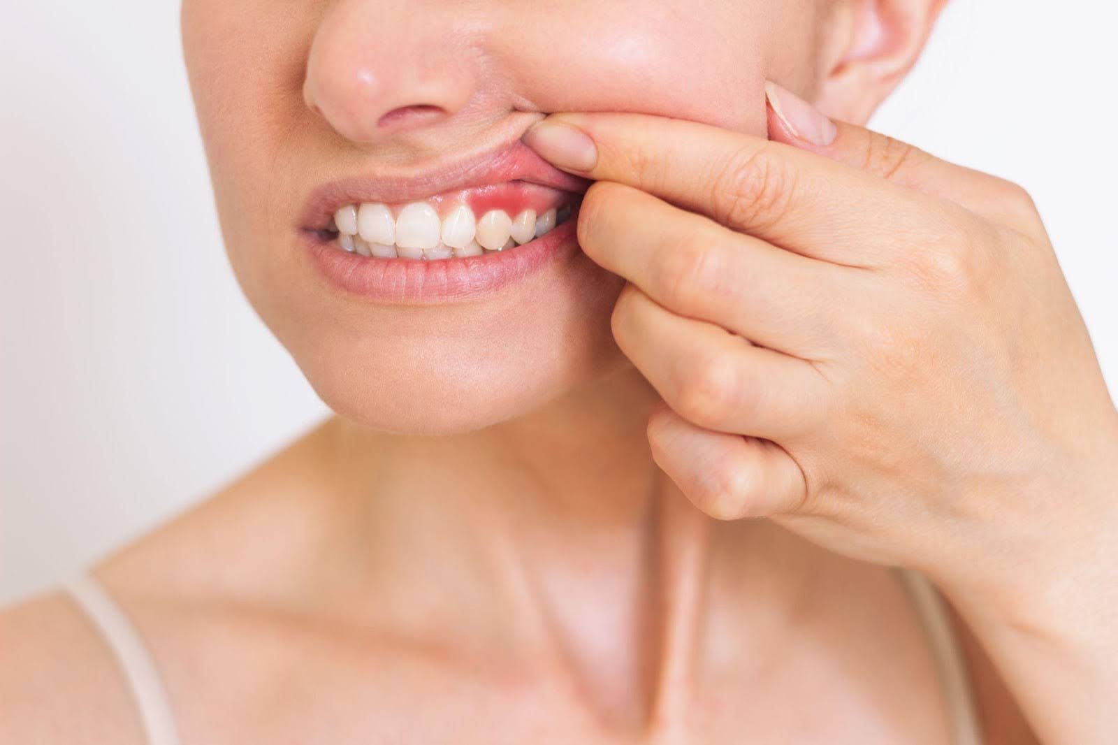 Periodontal Treatment 101: Everything You Need to Know